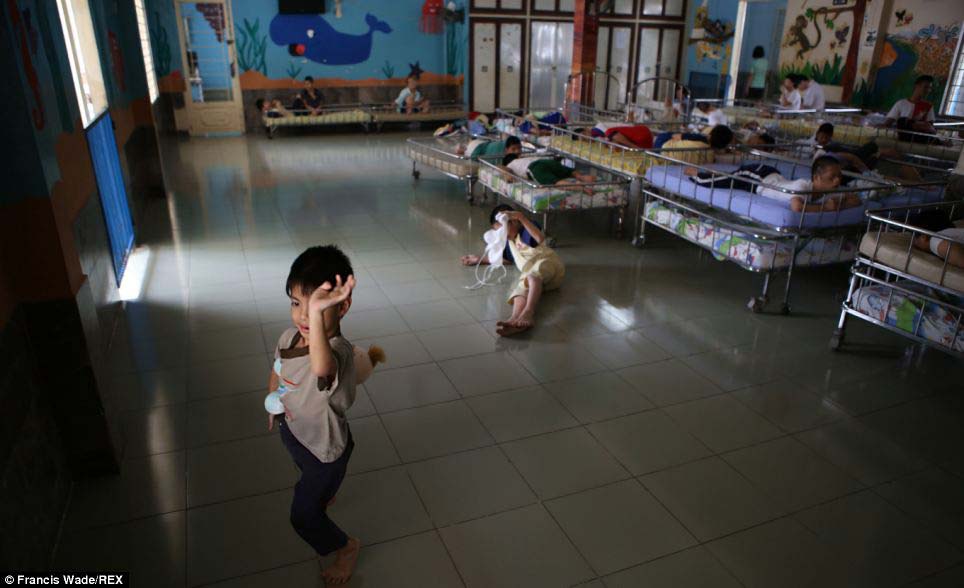 Los terribles efectos de los tóxicos usados por EU en Vietnam