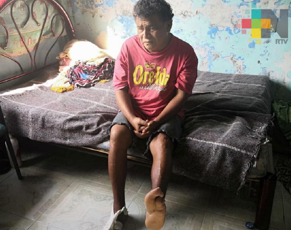Ciudadano pide apoyo para continuar tratamiento de diabetes, en Coatzacoalcos
