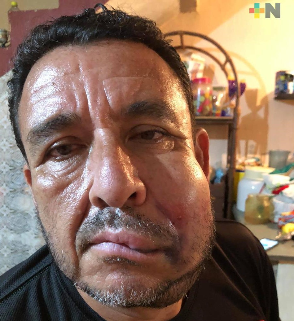 Por agredir a árbitro en juego amistoso, separan a jugador del Club Veracruzano de Futbol Tiburón