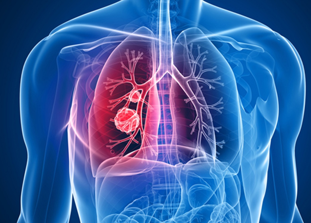 UNAM ofrecerá innovador radiofármaco que reducirá el tiempo de detección de cáncer
