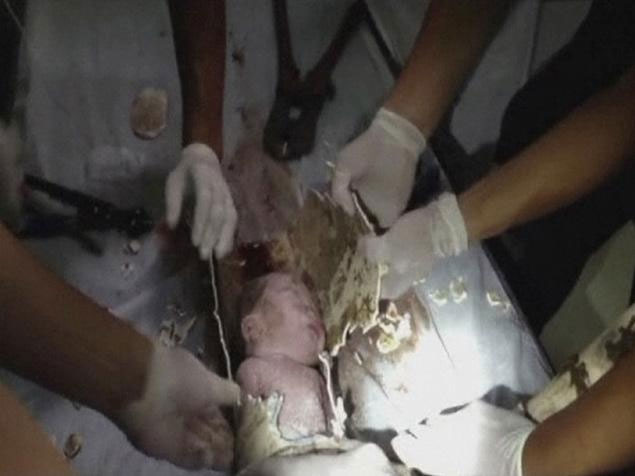 Indignación en China: tiran a recién nacido por inodoro; es rescatado vivo