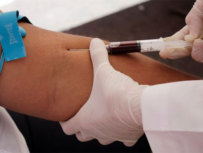 Disminuye propagación del sida 33% desde 2001