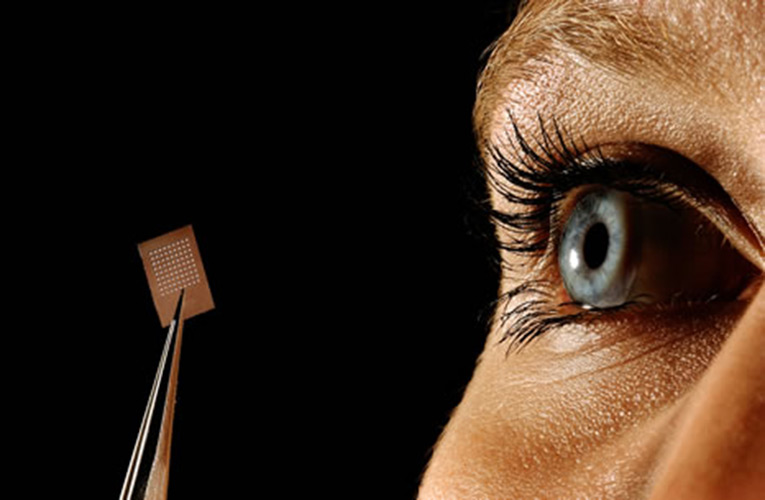 El microchip que permite ver a los ciegos