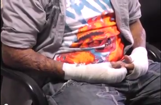 La fundación te queremos ayudar para niños quemados exhorta a los padres de familia a no comprar cohetes a sus hijos