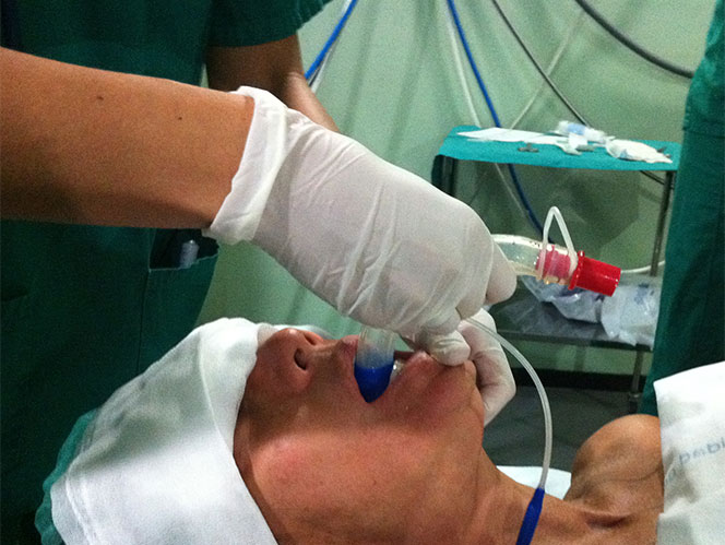 Cuidado con las broncoaspiraciones y neumonías que llegan con este clima