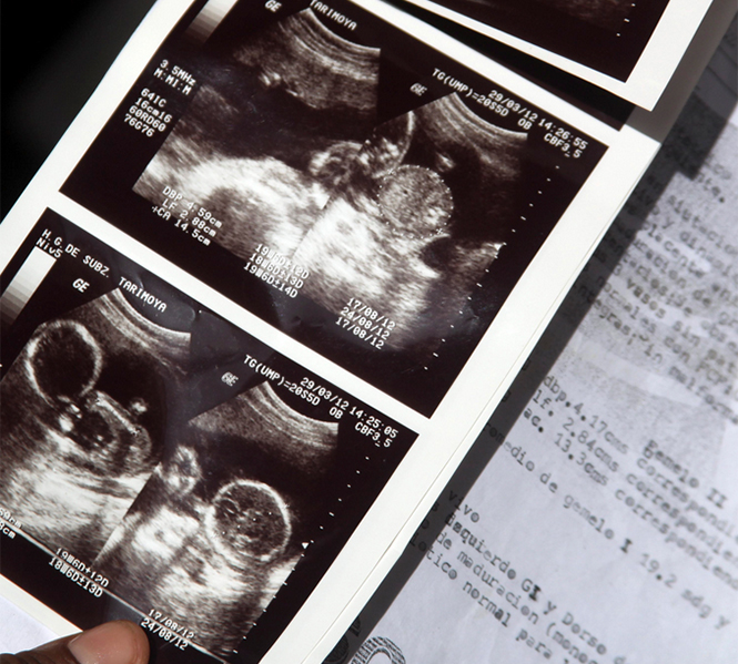 ‘No soy Dios para garantizarle la salud’: Médico ante muerte de bebés