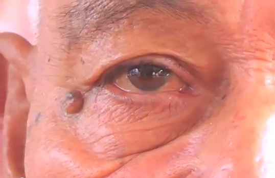 Inicia campaña la Regiduría de Salud “Abre los ojos a la vida”