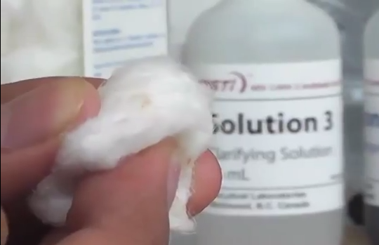 Las enfermedades de transmisión sexual están a la baja en la zona sur.