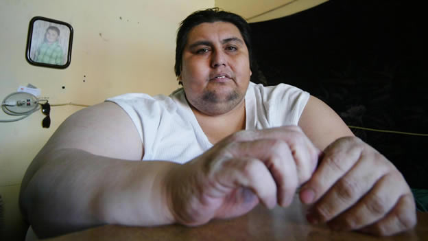 Muere Manuel Uribe, quien fuera el hombre más obeso del mundo
