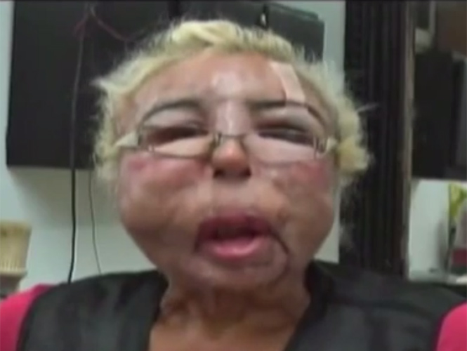 VIDEO: Quería lucir siempre joven y deforma su rostro