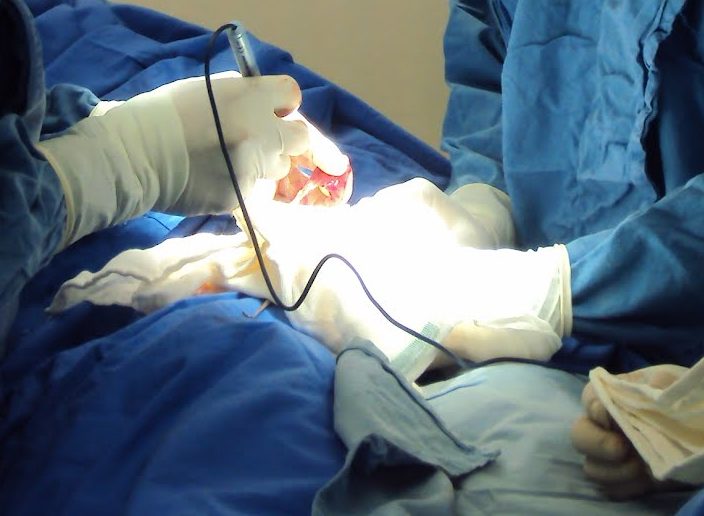 Médicos del IMSS extraen y reimplantan útero y feto para retirar tumor de 22 centímetros