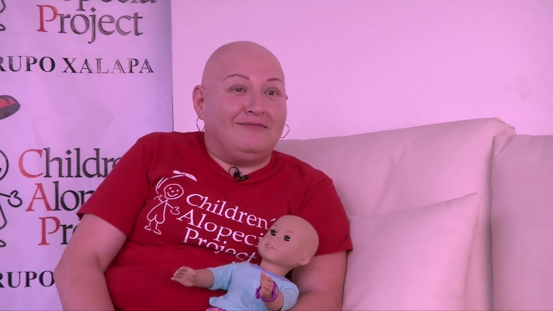 Alopecia,  más que perder cabello (Parte I)