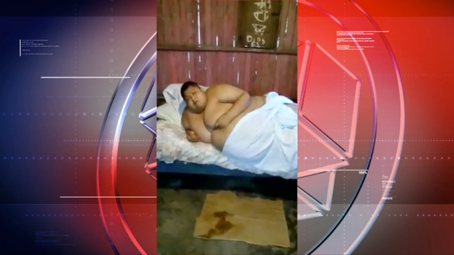 Atienden a joven de 220 kilos en Hospital Regional de Alta Especialidad de Veracruz