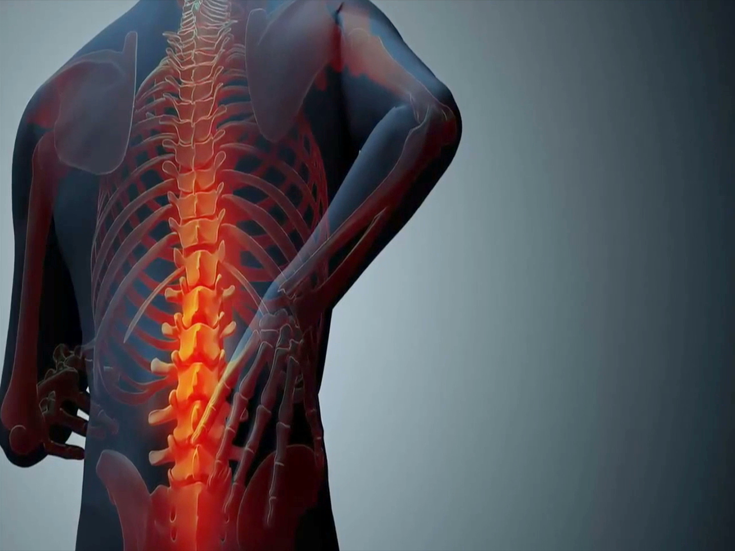 Osteoporosis, enfermedad silenciosa pero prevenible