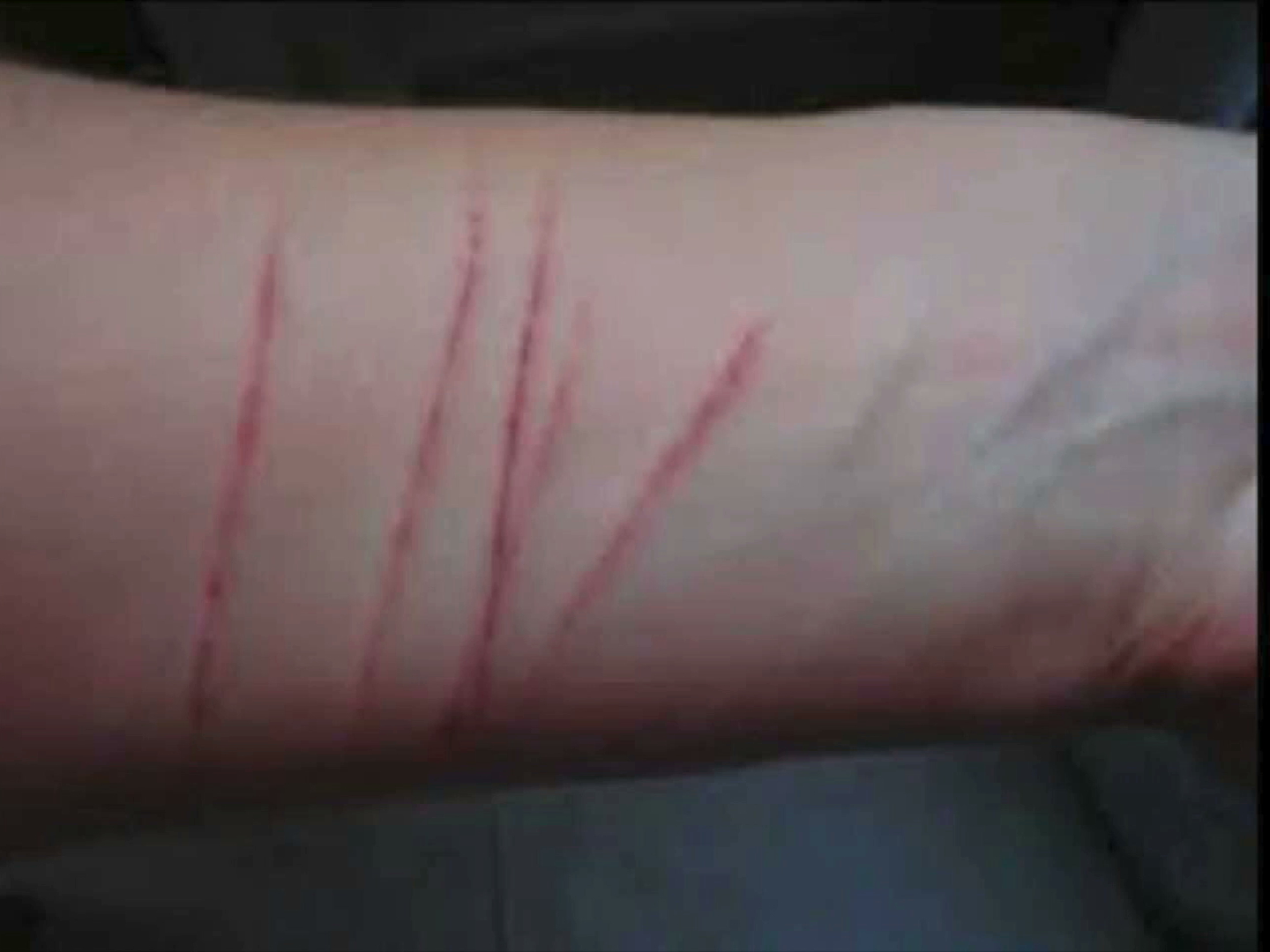 Redes sociales promueven prácticas peligrosas entre adolescentes