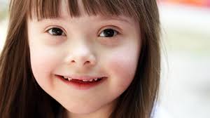 El tenis, alternativa para el desarrollo cognitivo de personas con Síndrome de Down