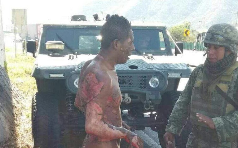 Persona con quemaduras tras explosión de ducto de Pemex que era ‘ordeñado’ en Balastrera