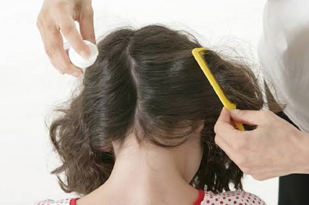 La pediculosis un riesgo latente y permanente de contagio, principalmente en infantes