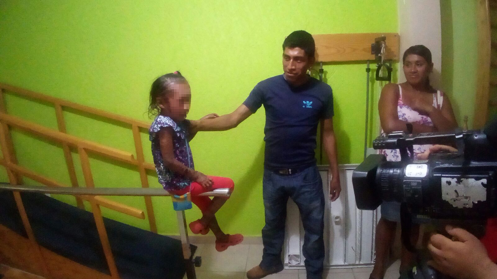 En Coatzacoalcos pobladores con ictiosis sufren de discriminación