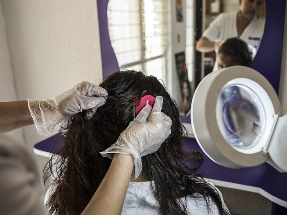 Seguro Social en Jalisco pide acudir al médico ante posible contagio de piojos