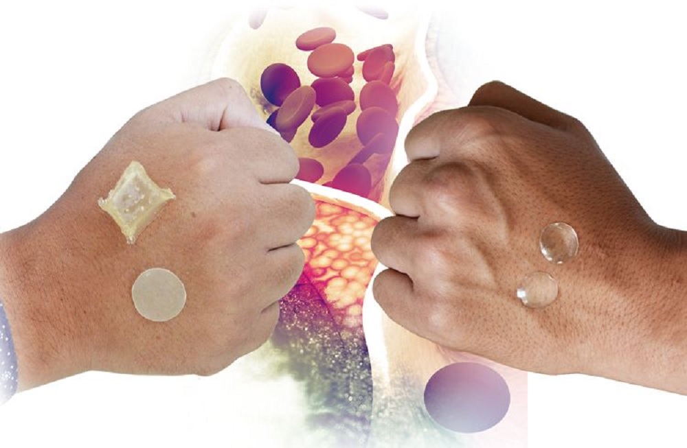 Universitarios crean parche transdérmico para combatir colesterol