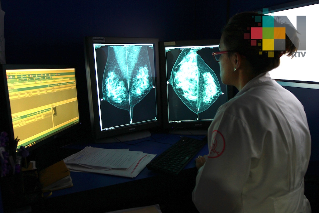 Detección temprana del cáncer de seno, vital para su prevención