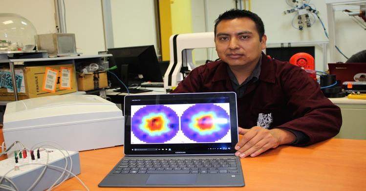 Alumno del IPN desarrolla dispositivo para prediagnosticar osteoporosis
