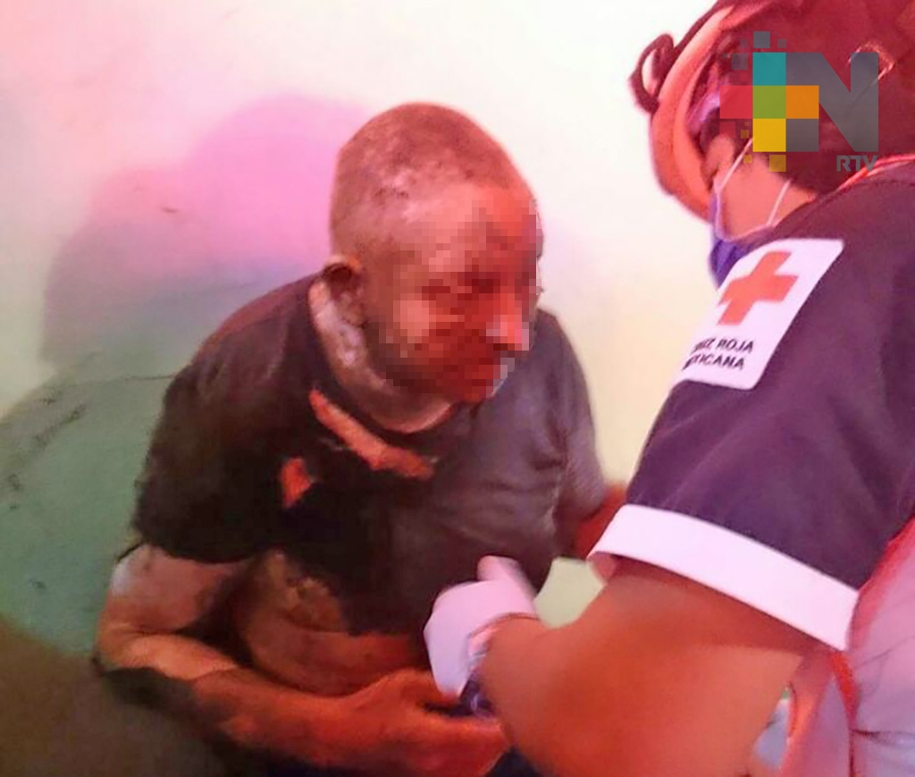 Prenden fuego a indigente mientras dormía, en Minatitlán