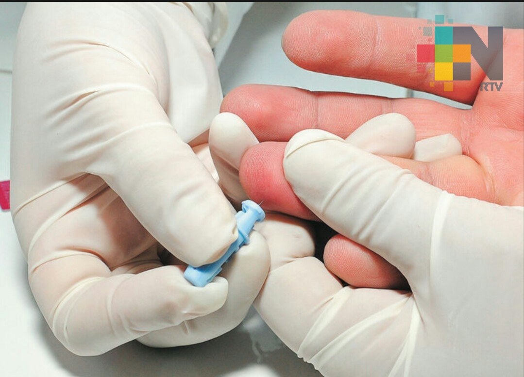 Veracruz tercer lugar a nivel nacional en casos de VIH Sida