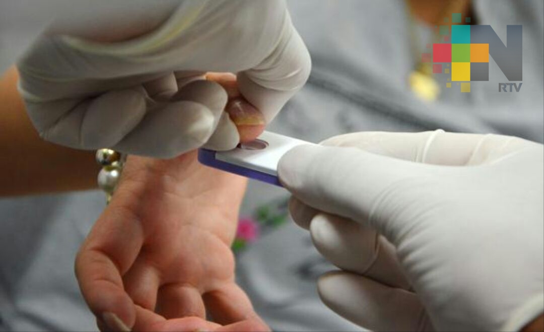 Realizan jornada de pruebas rápidas gratuitas de VIH en el parque Juárez de Xalapa