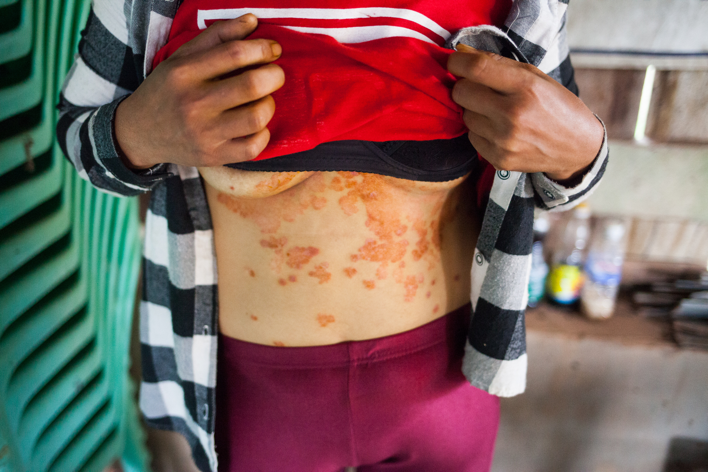 “Mi enfermedad no tiene cura”: las secuelas de la Guerra de Vietnam