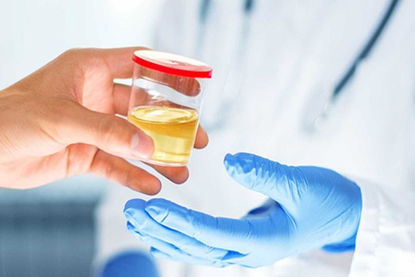 Análisis de orina determina envejecimiento biológico