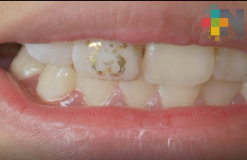 En Otilpan llevan un programa de salud bucal infantil, pionero en el país