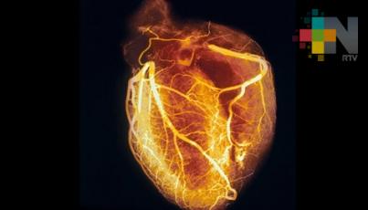 Insuficiencia cardiaca, entre primeras causas de muerte y discapacidad