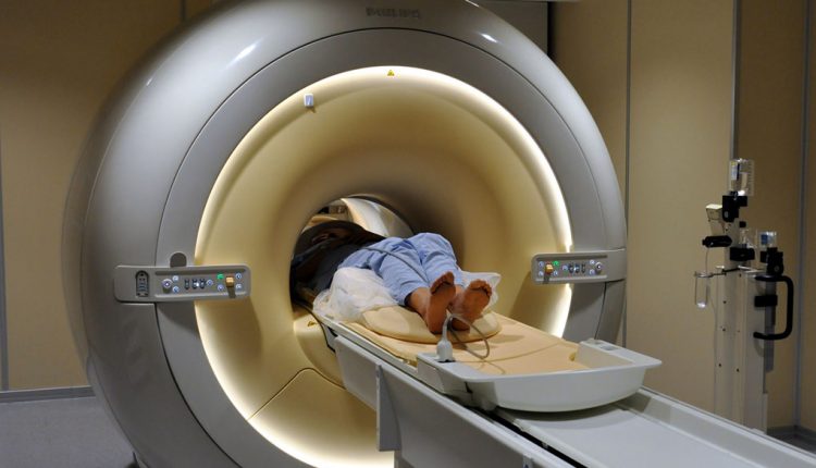Tecnología láser ayuda a extirpar tumores cerebrales con mínima invasión