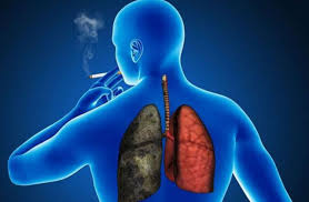 Pandemia redujo casos diagnosticados con cáncer de pulmón