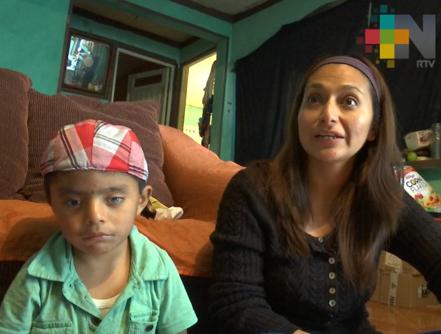 Madre pide ayuda para tratar problema ocular de su hijo