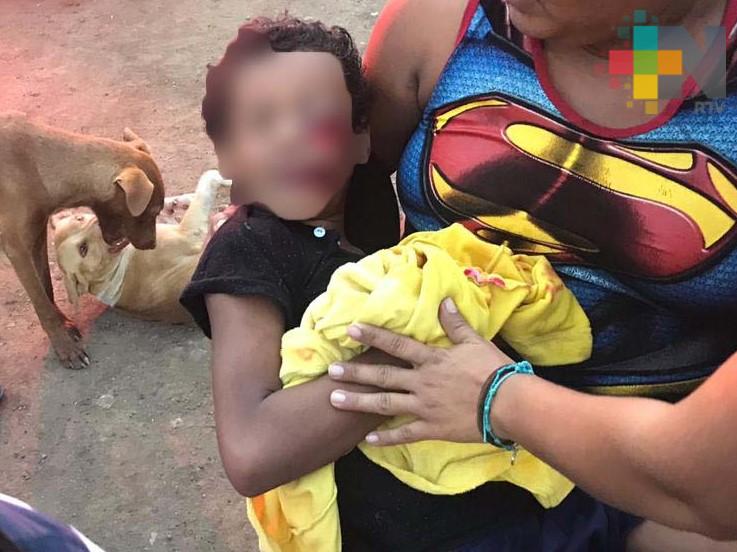 Atienden a niño lesionado por explosión de cohete, en Veracruz