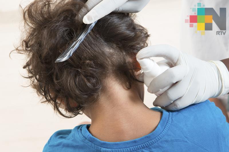 En temporada de calor aumentan casos de varicela y pediculosis