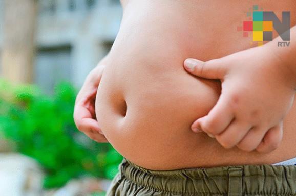 Más del 30% de niños menores de seis años en la zona sur son obesos, revela estudio