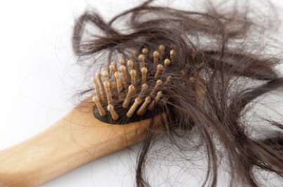 Pérdida de cabello está asociada al estrés y ansiedad