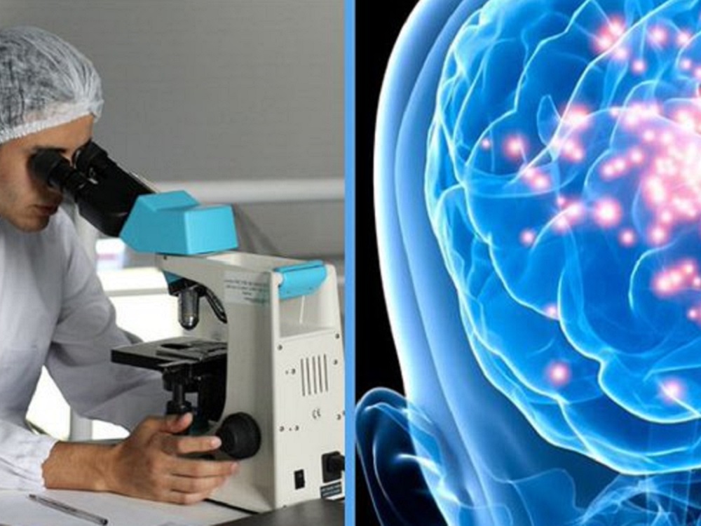 Científicos de la UNAM, listos para erradicar la cisticercosis en el país