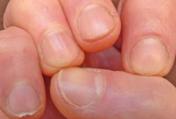 Los colores de las uñas reflejan padecimientos de salud: Experta