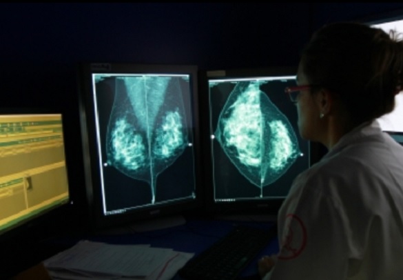 Nuevo método para detectar el cáncer de mama en 10 minutos