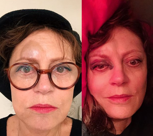 Susan Sarandon sufre conmoción cerebral tras caída