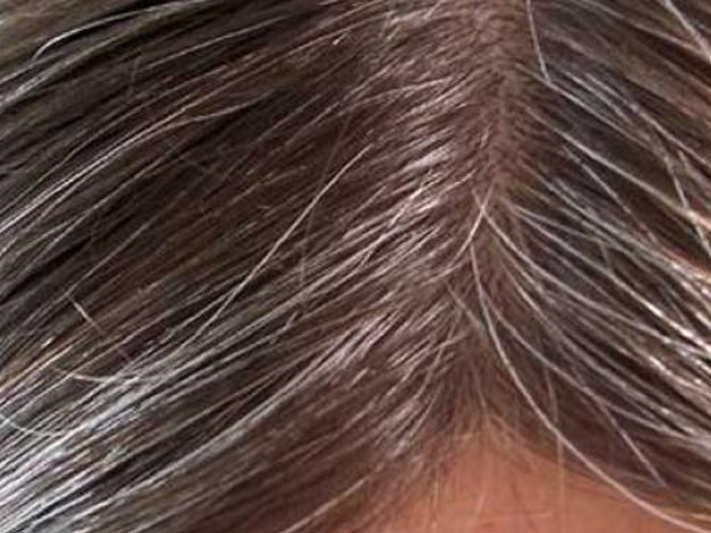 Cómo el estrés se transforma en canas