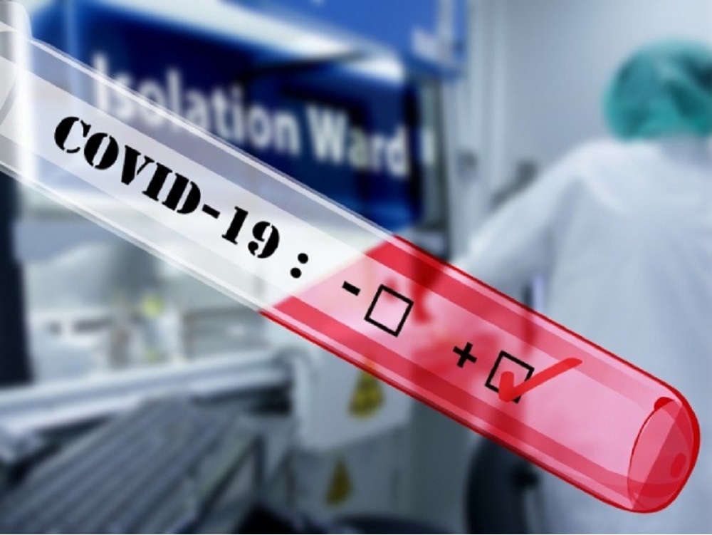 Empresa de EUA crea prueba que detecta Coronavirus en cinco minutos