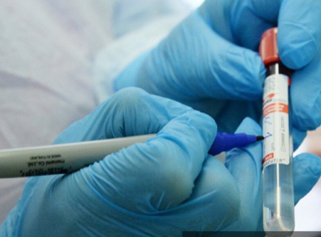 Jóvenes no son inmunes a COVID-19: ISSSTE