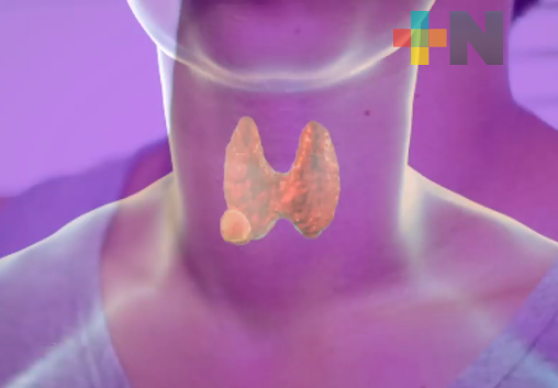 En México, cada año surge un promedio de tres mil casos de cáncer de tiroides