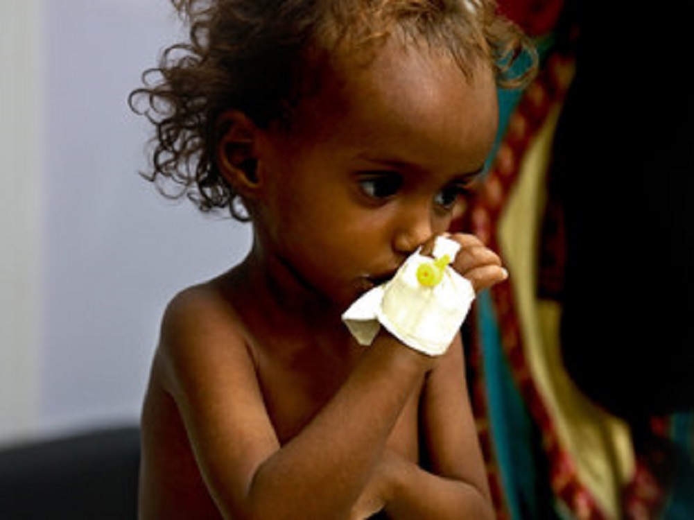 Yemen podría tener más de un millón de infectados con coronavirus